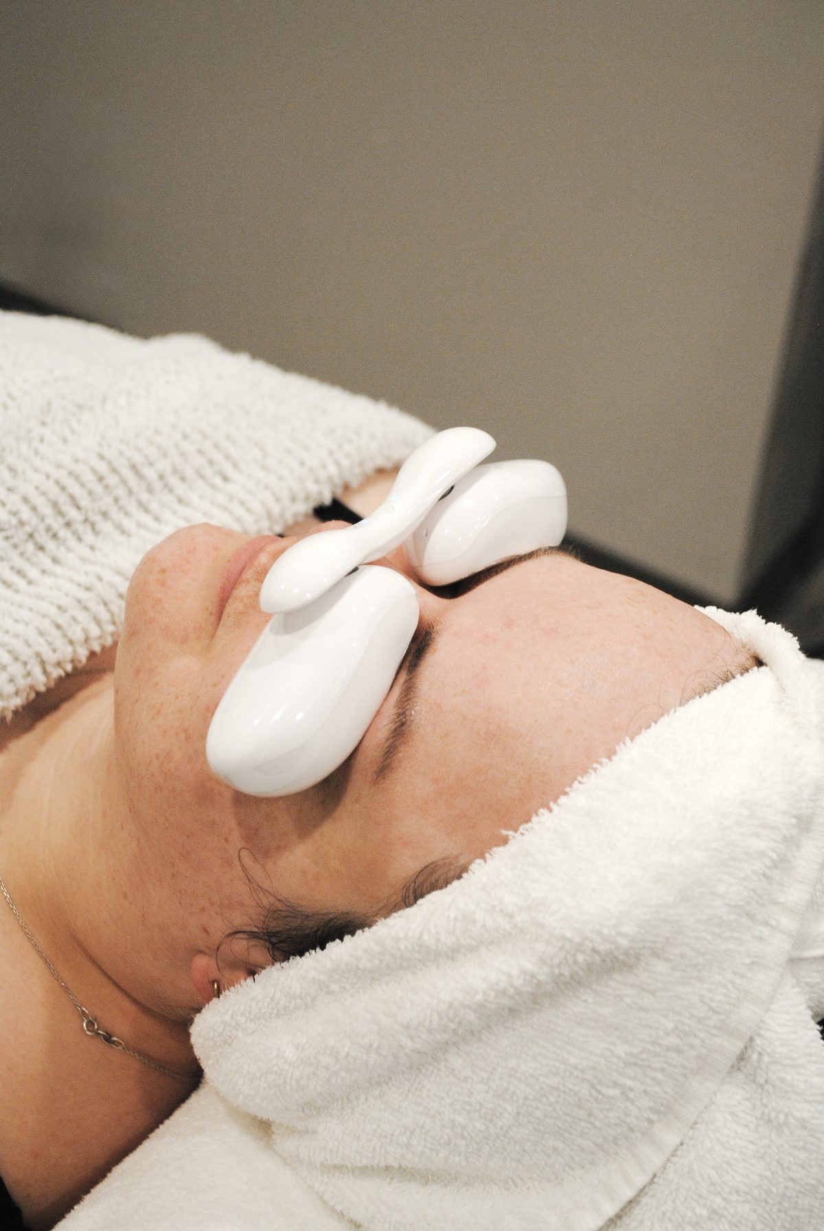 Plexr eyelid treatment at Focus Aesthetics